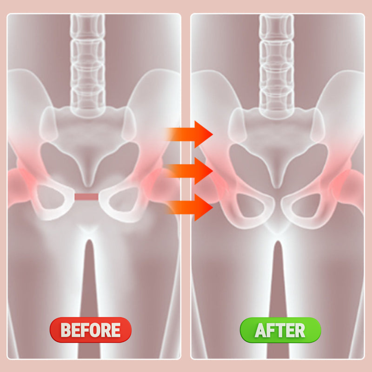 Kegel Trainer – Pelvic Floor Muscle Exerciser